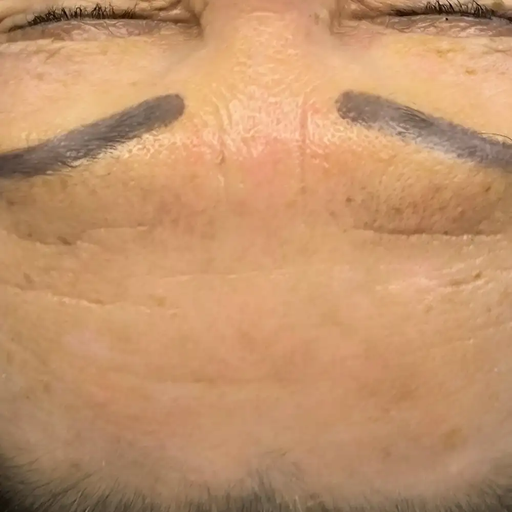 PO