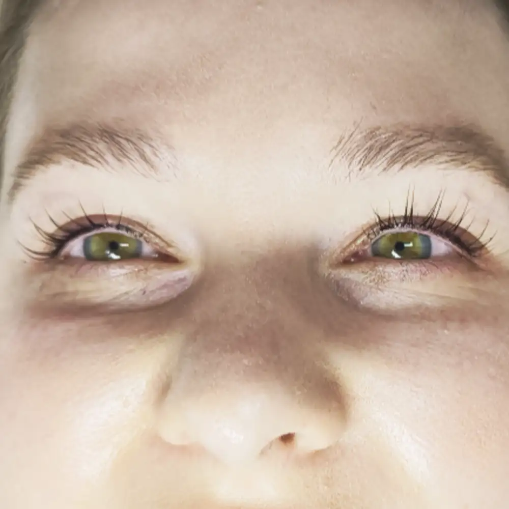 Po ošetrení: Luxusný pohľad - trvalá mihalníc + farbenie a botox (LashLift) – Klientka, 31 r. — silný lifting mihalníc (2. pohľad)
