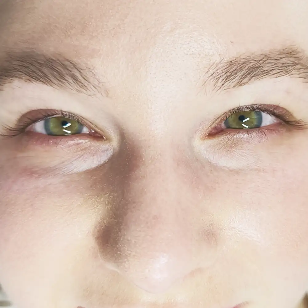 Pred ošetrením: Luxusný pohľad - trvalá mihalníc + farbenie a botox (LashLift) – Klientka, 31 r. — silný lifting mihalníc (2. pohľad)
