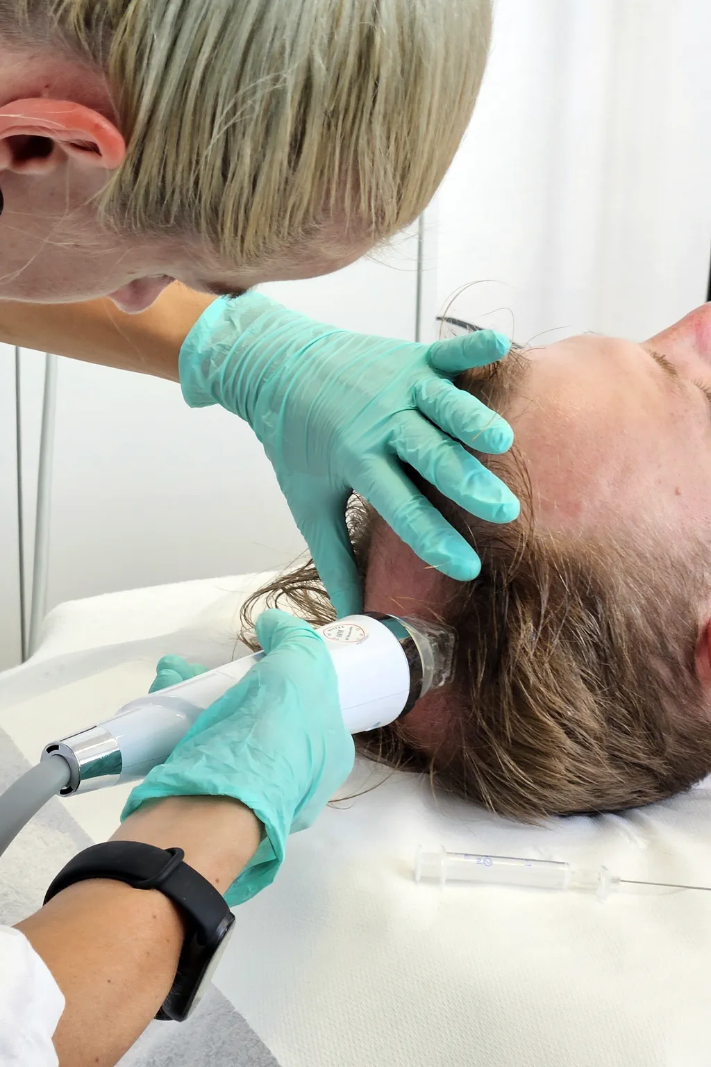 Vlasová mezoterapia