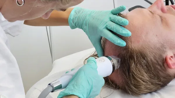 Vlasová mezoterapia